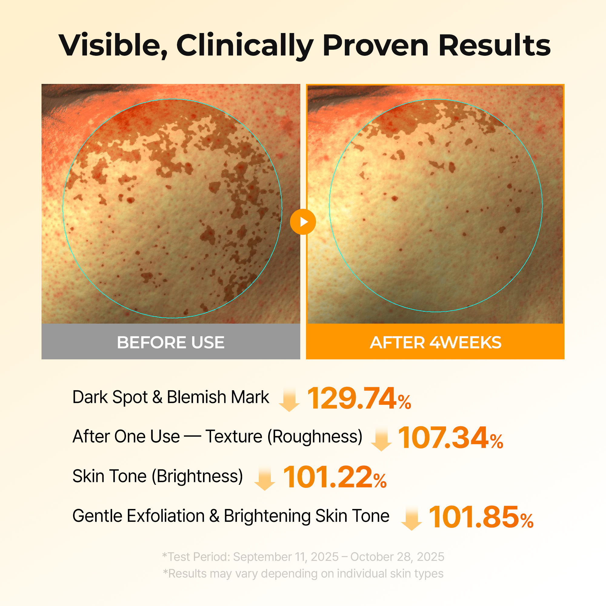 Kojic Acid Turmeric TX Toner Pad 70pads - image 3